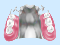 入れ歯治療